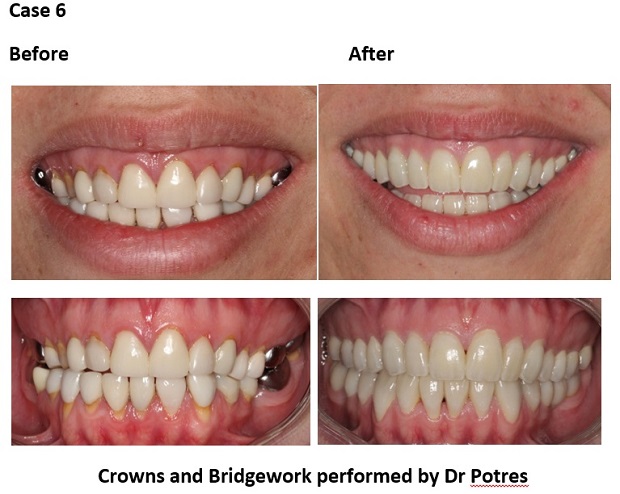 cosmetic dentistry before and after 77